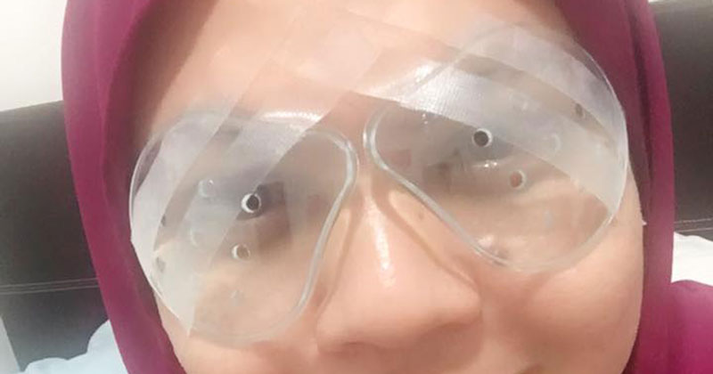 Lasik Pada Harga Jimat, Mata Saya Terus Cerah Selepas Hari Kedua Pembedahan