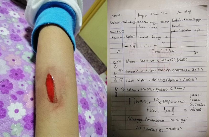 Lihat Kemahiran Kanak-Kanak Ini 'Melukis' Luka Yang Sangat Realistik