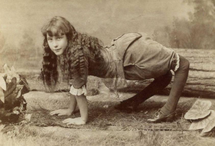 Ella Harper Si 'Gadis Unta', Bagaimana Dia Gunakan Kekurangannya Untuk Meraih Populariti Pada Tahun 1886
