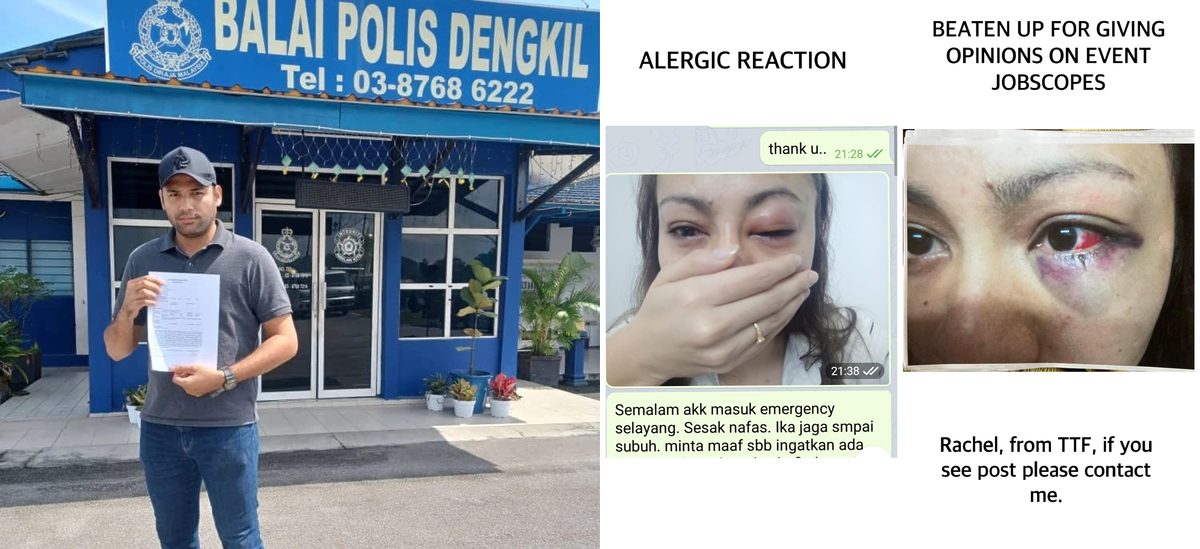 Isteri Afiq Muiz Nafi Tuduhan Buat Cerita, Tunjuk Bukti Badan Lebam Dan Jari Patah Akibat Dipukul