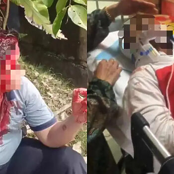 Gara-Gara Pemadam, Pelajar Sekolah Di Johor Bergaduh Sehingga Berdarah Kepala