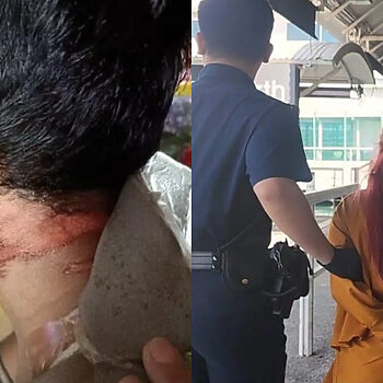 Wanita Indonesia 'Travel' Ke Singapura Demi Cederakan Suami Warga Malaysia Kerana Minta Cerai