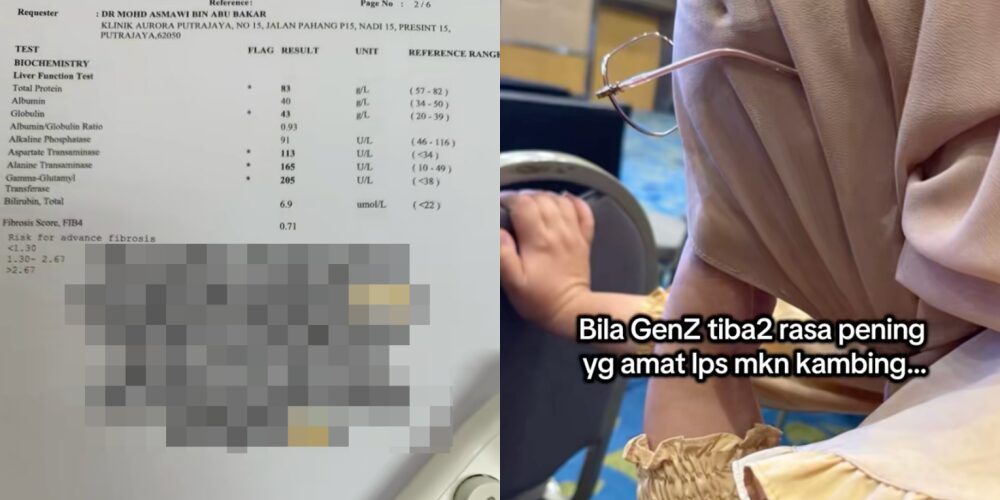 Muda Lagi Tapi Enjin Dah 'Tenat'? Tindakan Bos Paksa Staf Gen Z 'Check-up' Bongkar Realiti Pahit